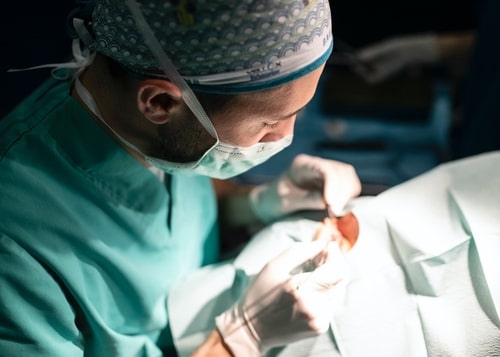 ICL - Implantable Collamer Lens